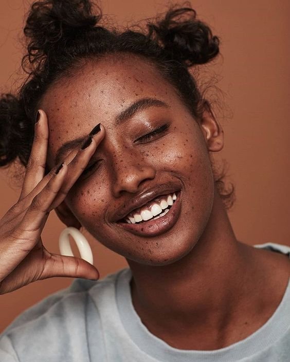 hyperpigmentation